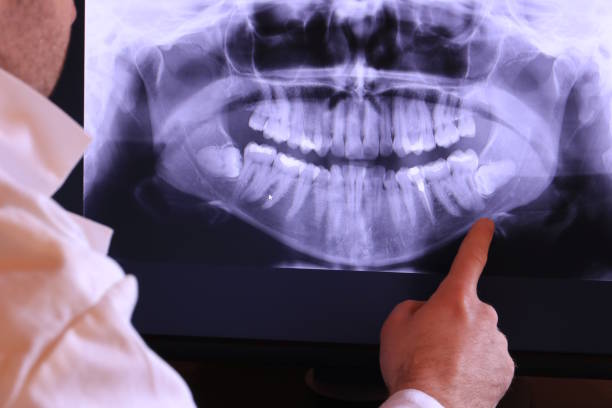 Best Emergency Root Canal Therapy in West Columbia, TX