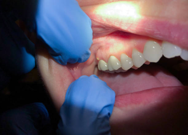 Best Emergency Cosmetic Dentistry (e.g., broken veneers) in West Columbia, TX